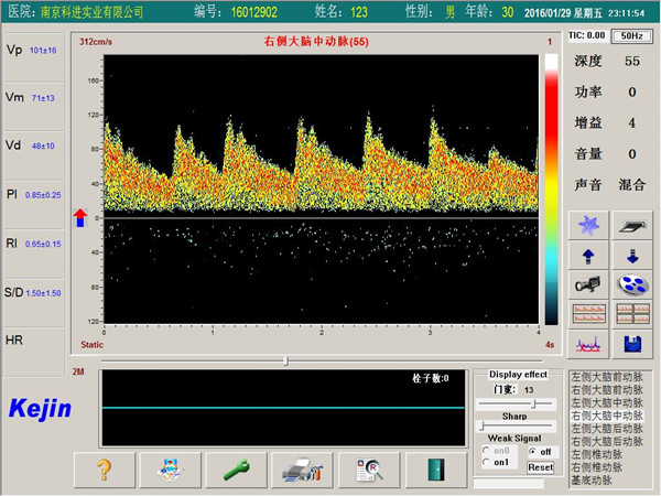 PW模式下單窗口檢測界面 PW模式下單窗口檢測界面.jpg