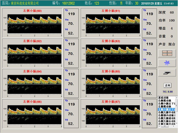 經(jīng)顱多普勒單通道,八深度界面 經(jīng)顱多普勒單通道,八深度界面