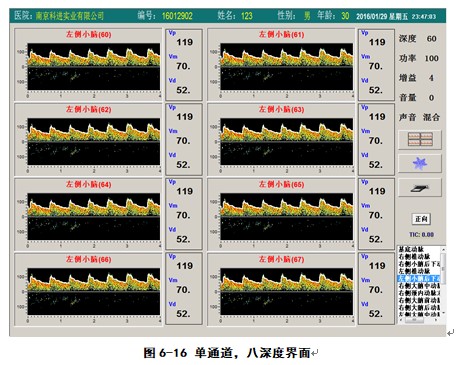 經顱多普勒軟件單通道八深度檢測界面